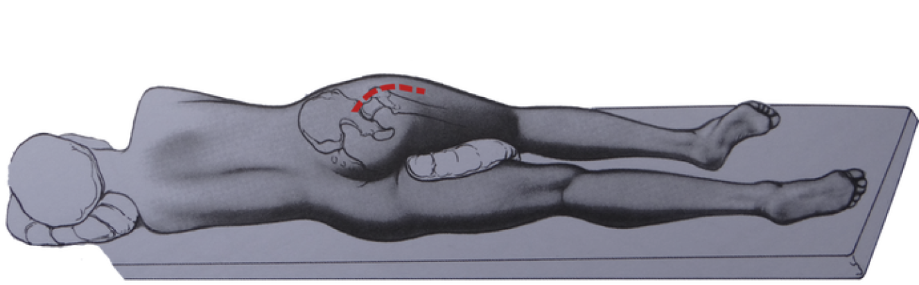 Imagem Abordagem Posterior